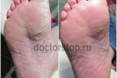 F5n6pd22iV0