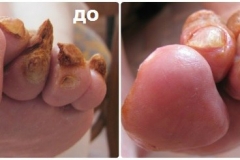 5tk_45mTR_8