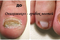 collageАндрей БорС1