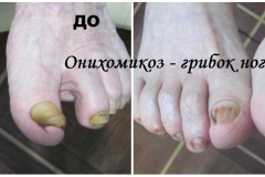 collageГрибок2.1