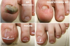 collageОляОнихогр1.1