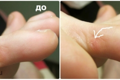 collageСтержнКс1.1