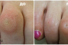 collageСтержнНеля1